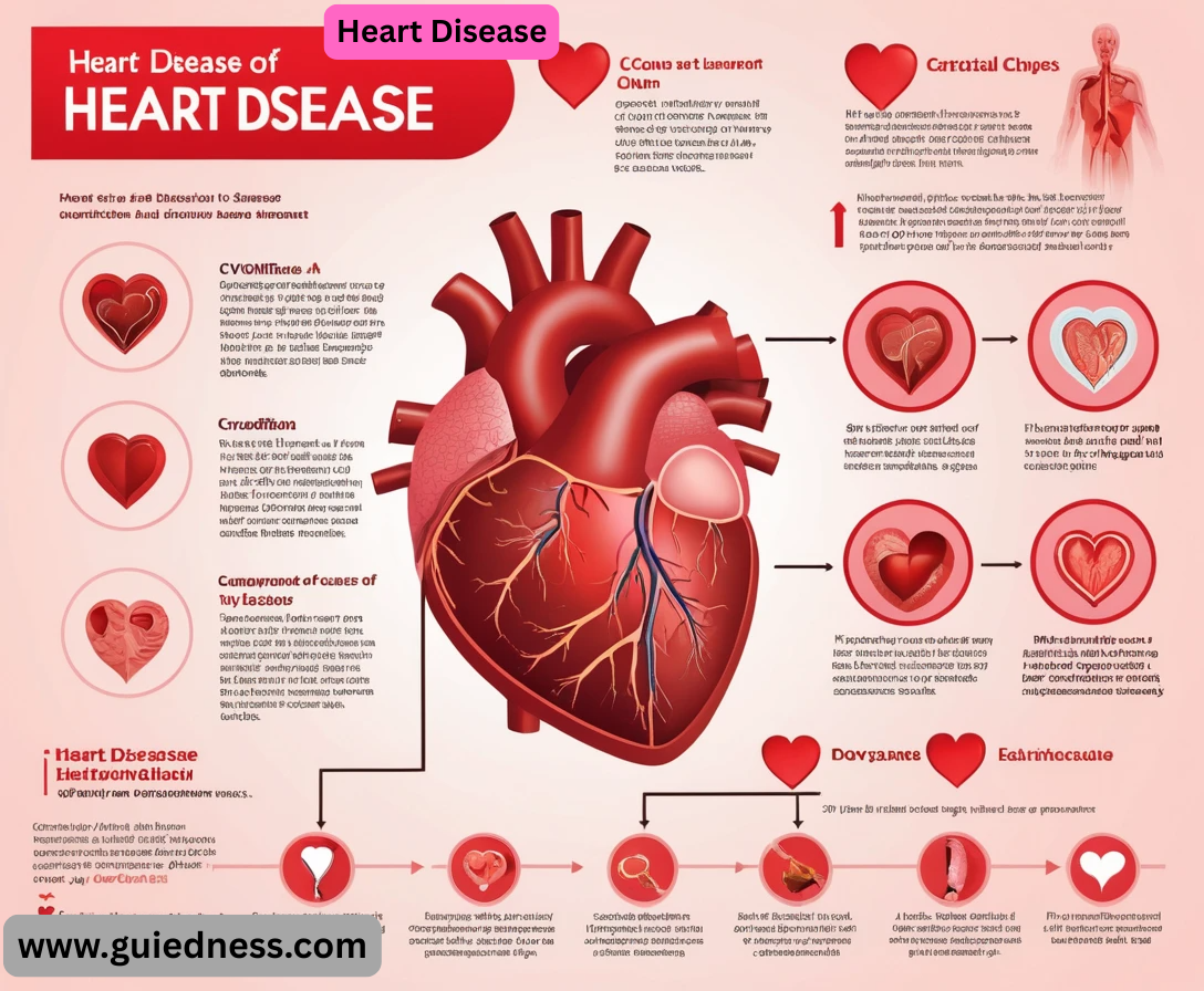 Heart Disease