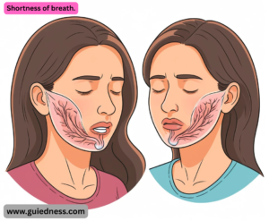 Shortness of breath.